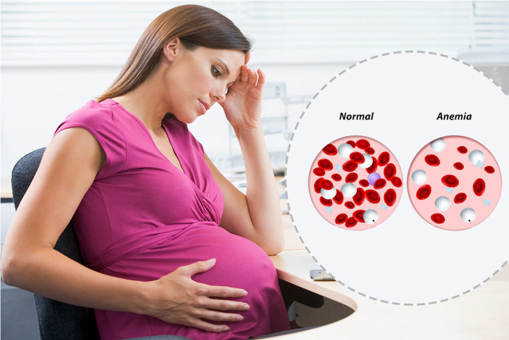 Hậu quả sức khỏe của bệnh thiếu máu đối với người mang thai